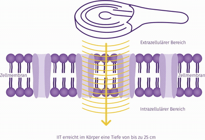 Wie IIT wirkt – Darstellung der Zellmembran und Ionen-Induktion